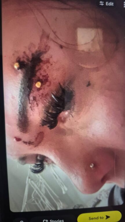 Father Demands Answers After Video Appears To Show 15-Year-Old Daughter Restrained And Carried Into Police Van In Southampton