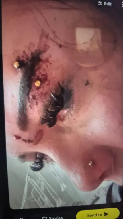 Father Demands Answers After Video Appears To Show 15-Year-Old Daughter Restrained And Carried Into Police Van In Southampton